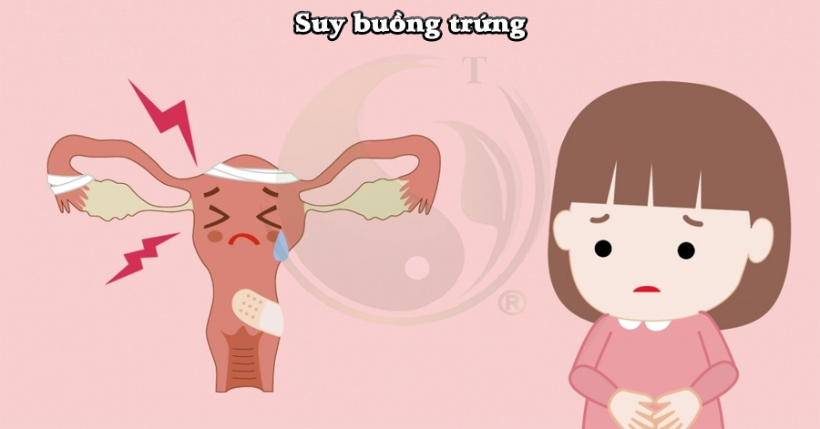 Suy buồng trứng nguyên nhân
